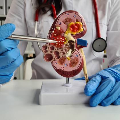 experiencia de nefrologo en naucalpan