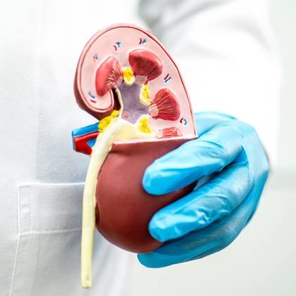 hemodialisis en cdmx