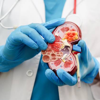 Mejor Nefrología en miguel hidalgo cdmx