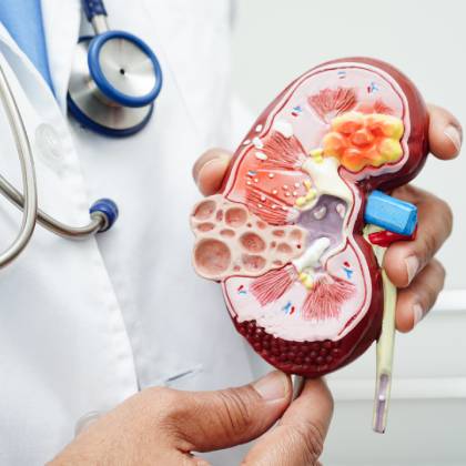 terapia de nefrologia en ciudad satelite